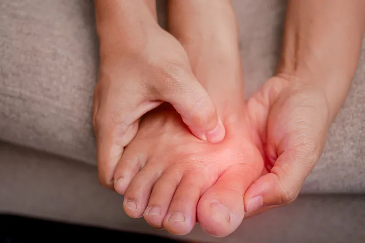 Are Bunions Hereditary?