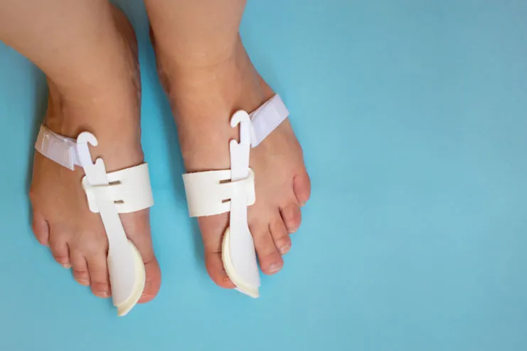 How to Recover After Bunion or Hammer Toe Surgery