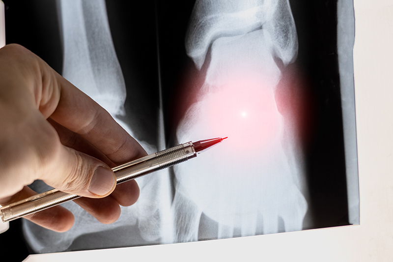 Doctor examining an ankle X-ray for clinical assessment