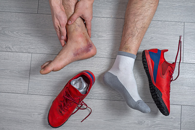 Why Persistent Ankle Symptoms Are Not Always Caused by a Simple Sprain 