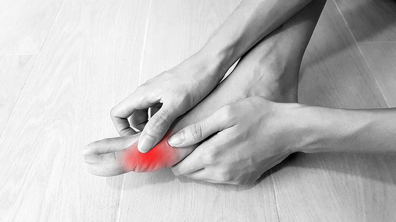 How to Reduce Bunion Pain Without Surgery 