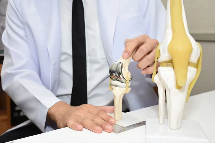 Everything You Need to Know About Total Knee Replacement