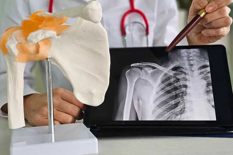 Shoulder Surgery Explained