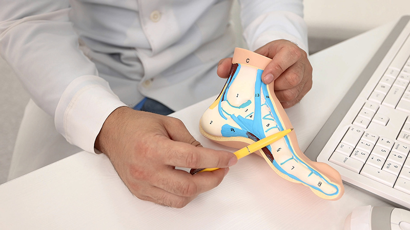 A specialist referring to a model of the human foot in a consultation for flat feet