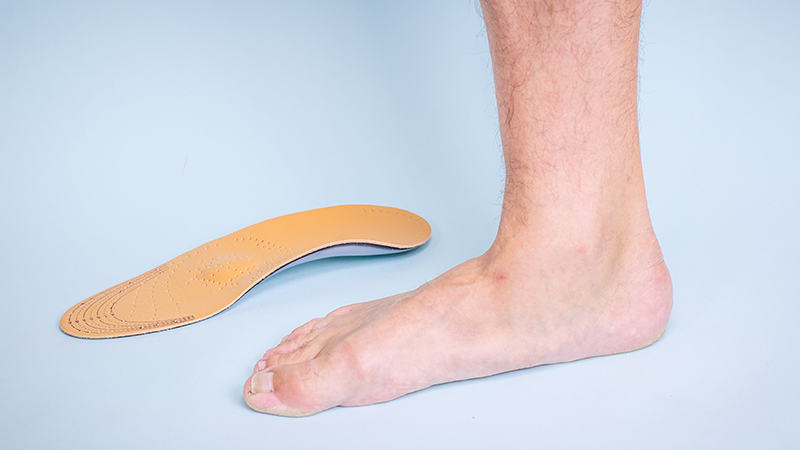 Close-up of a patient with flat feet