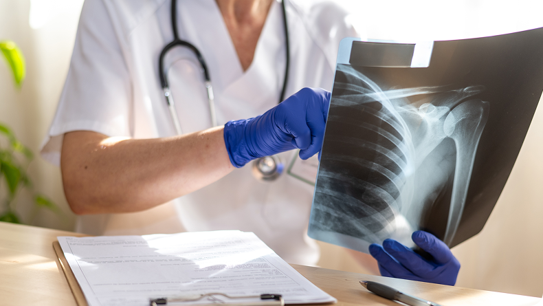 An orthopaedic surgeon examining a shoulder X-ray with a patient, representing specialist shoulder assessment and diagnosis in Singapore.